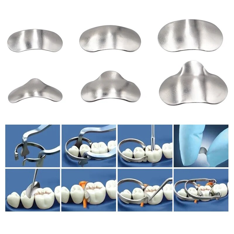 شريط نظام مصفوفة للأسنان ، لقط - مراجعة Resin Art Case وسعره